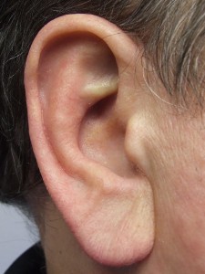 Prosthetic ear fitted with magnets for attachment, made by Greg Gion ...