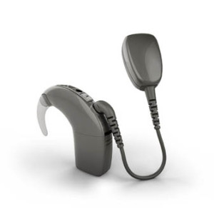 Cochlear Announces FDA Clearance of the First Smart Bone Conduction ...