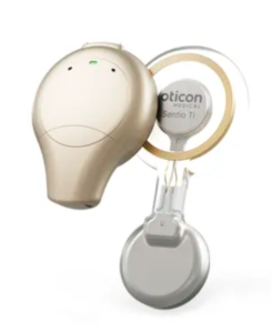 Oticon Medical Sentio System